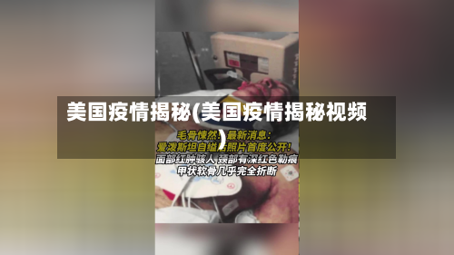 美国疫情揭秘(美国疫情揭秘视频)